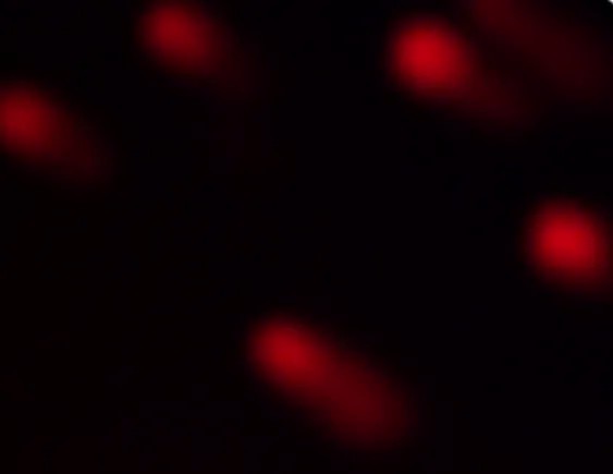 IPHASE : Comet assay kits facilitate in vitro genotoxicity studies